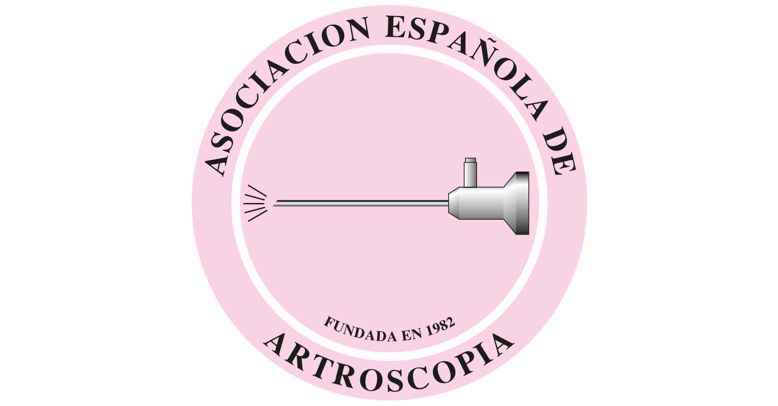 Artroscopia